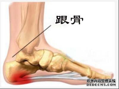 五年足跟骨骨刺被治愈